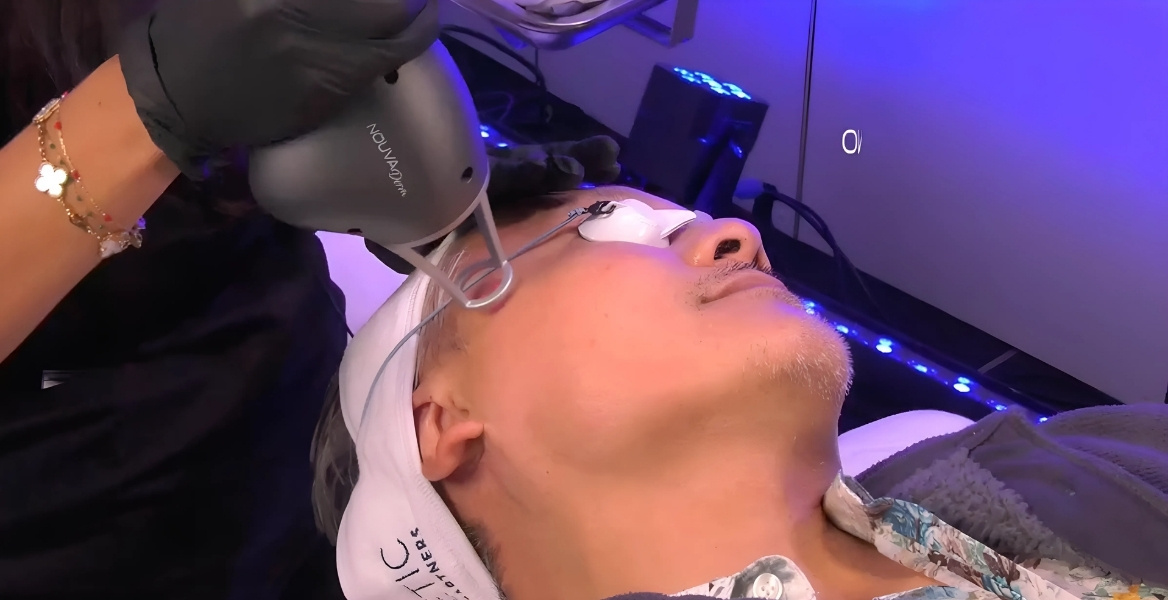 Nauvaderm Laser Treatment by Forest Wellness